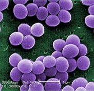 Staphylococcus aureus